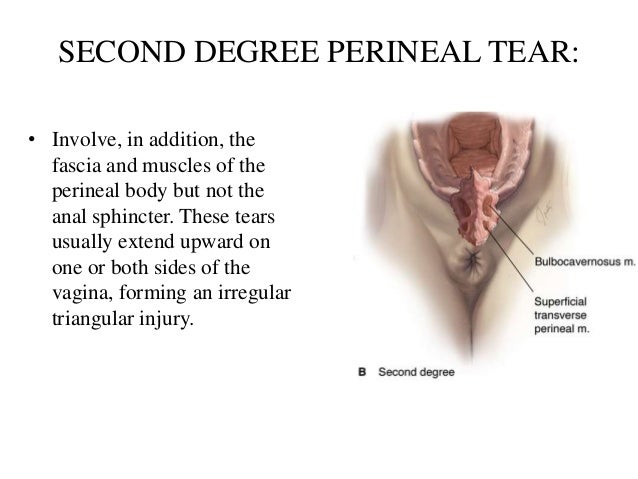 pictures of vaginal tears or episiotomy Sore in vagina area that bleeds